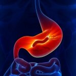 http://www.dreamstime.com/stock-image-helicobacter-pylori-stomach-image37933301