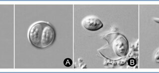 cyclospora