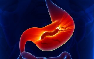 Low stomach acid and 6 common causes by Dr. Norm Robillard