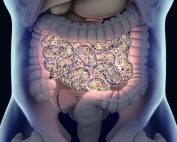 Can SIBO Diets Alone Restore a Healthy Microbiota?