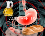 How to Stop Reflux – Going Beyond Trigger Foods for GERD by Dr. Norm Robillard